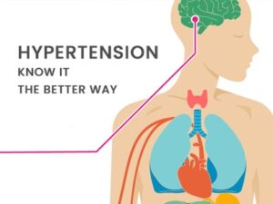 Read more about the article HYPERTENSION- KNOW IT THE BETTER WAY